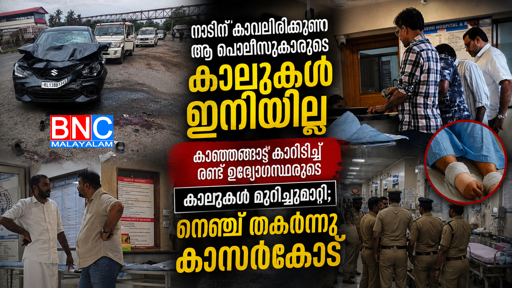 354: നാടിന് കാവലിരുന്ന കാലുകൾ മുറിച്ചുമാറ്റേണ്ടി വന്നു; ആശുപത്രി വരാന്തകളിൽ കണ്ണീരായി കാസർകോട്